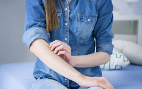 eczema itching arm