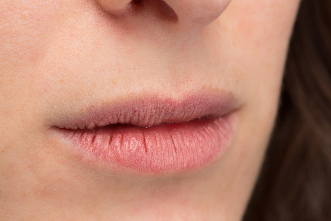 Say Goodbye To Dry Chapped Lips The Pretty Pimple